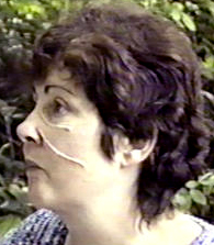 CU. Jennifer Duncan with thin strands of latex on her face