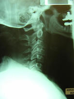 skeleton